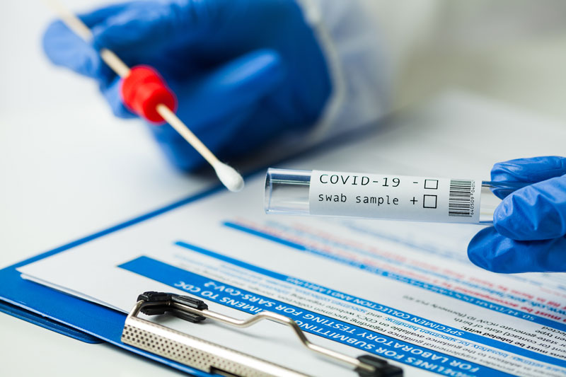 Kit de ensayo de muestreo de la prueba de COVID