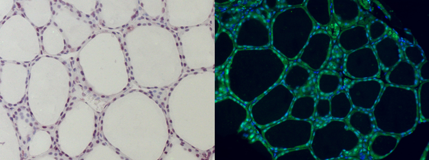 Detalles microscópicos de la tela de araña