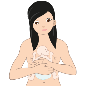 Ilustración que muestra a una mujer utilizando la técnica de madre canguro. 