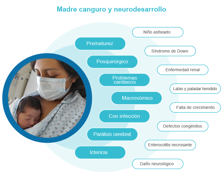 Enfermedades en las que se puede usar la técnica de madre canguro