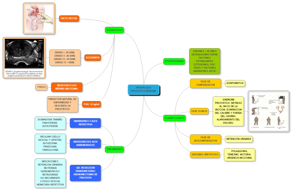 Mapa mental sobre hiperplasia prostática benigna