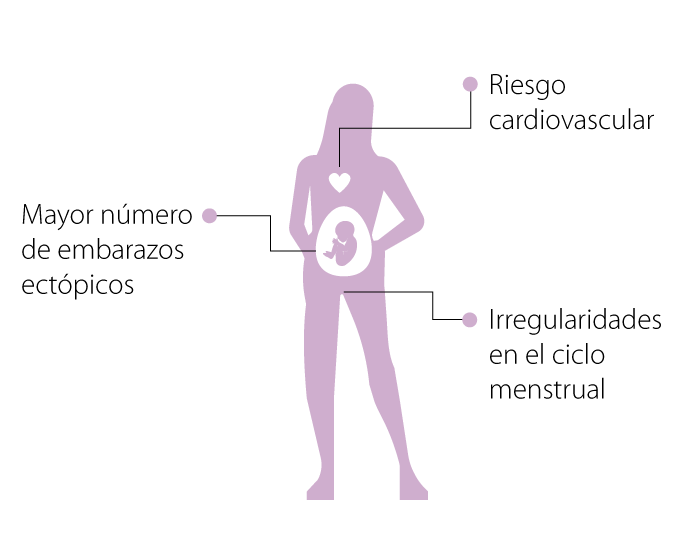 Ilustración que muestra el cuerpo de una mujer embarazada.