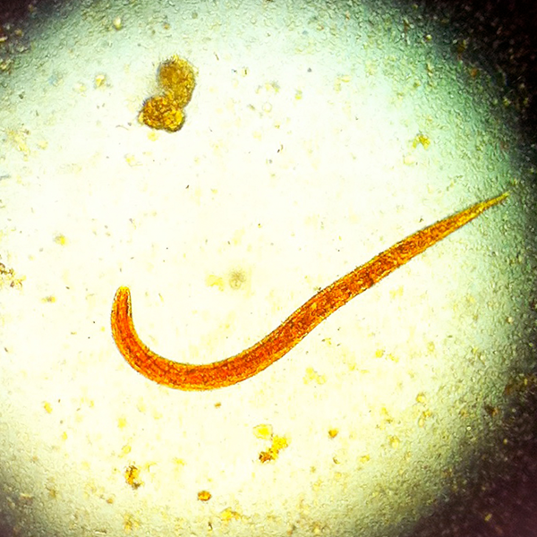 Fotografía del parásito desde un microscopio. 