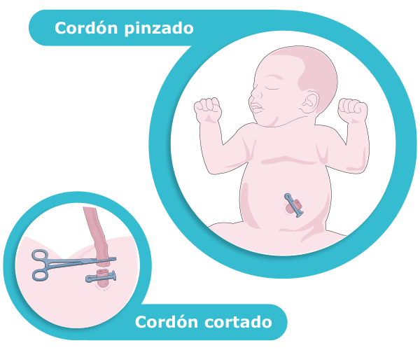Ilustración que muestra el corte del cordón umbilical. 