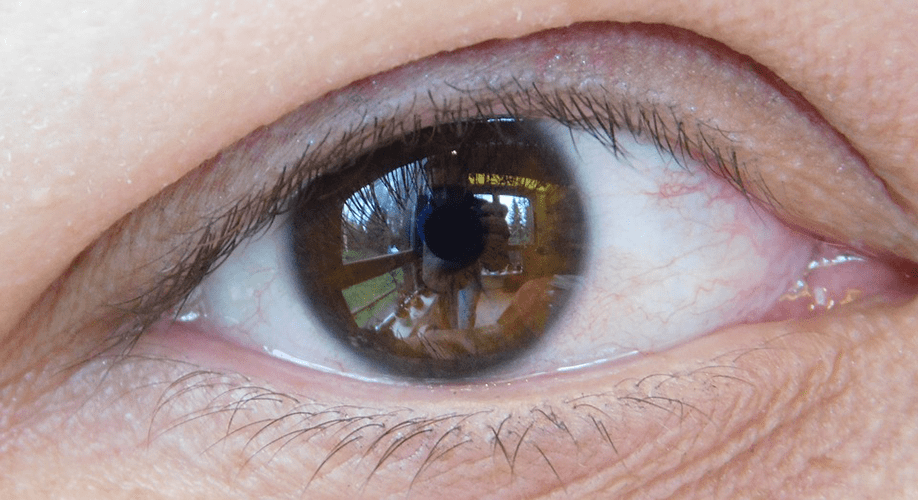 Ojo